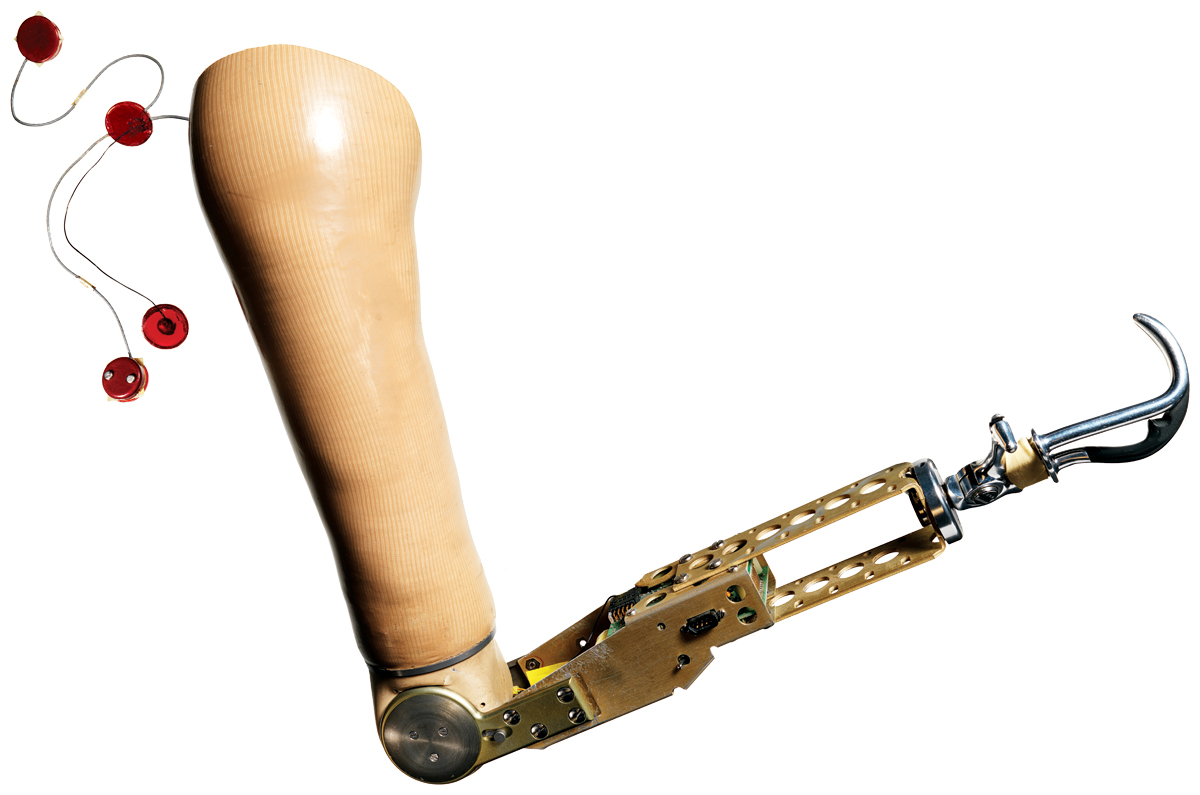 prosthetics-research-boston-1